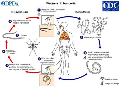 Phytochemical intervention for lymphatic filariasis and filarial lymphedema